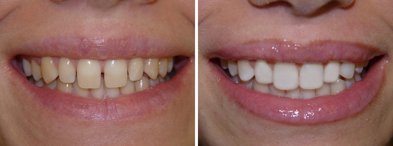 affordable cosmetic dentistry